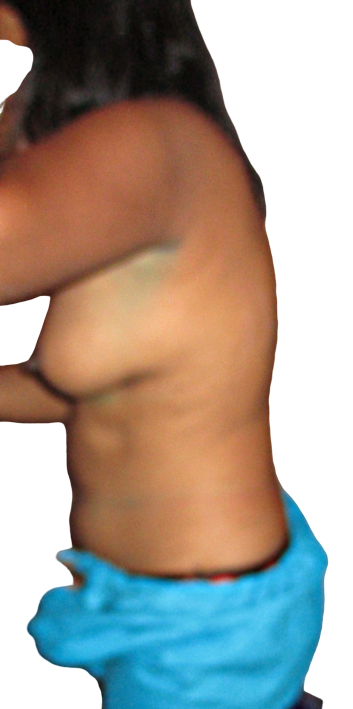 00